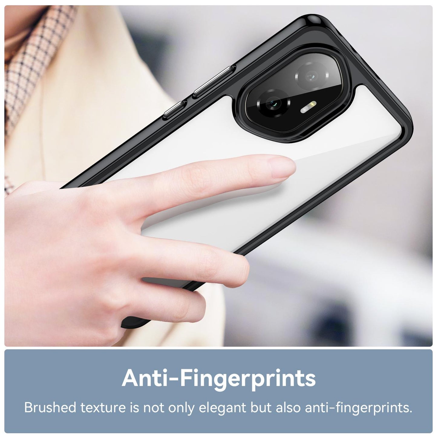Honor 300 Acrylic Hybrid TPU Protective Phone Case, Colourful Series Shockproof Cover