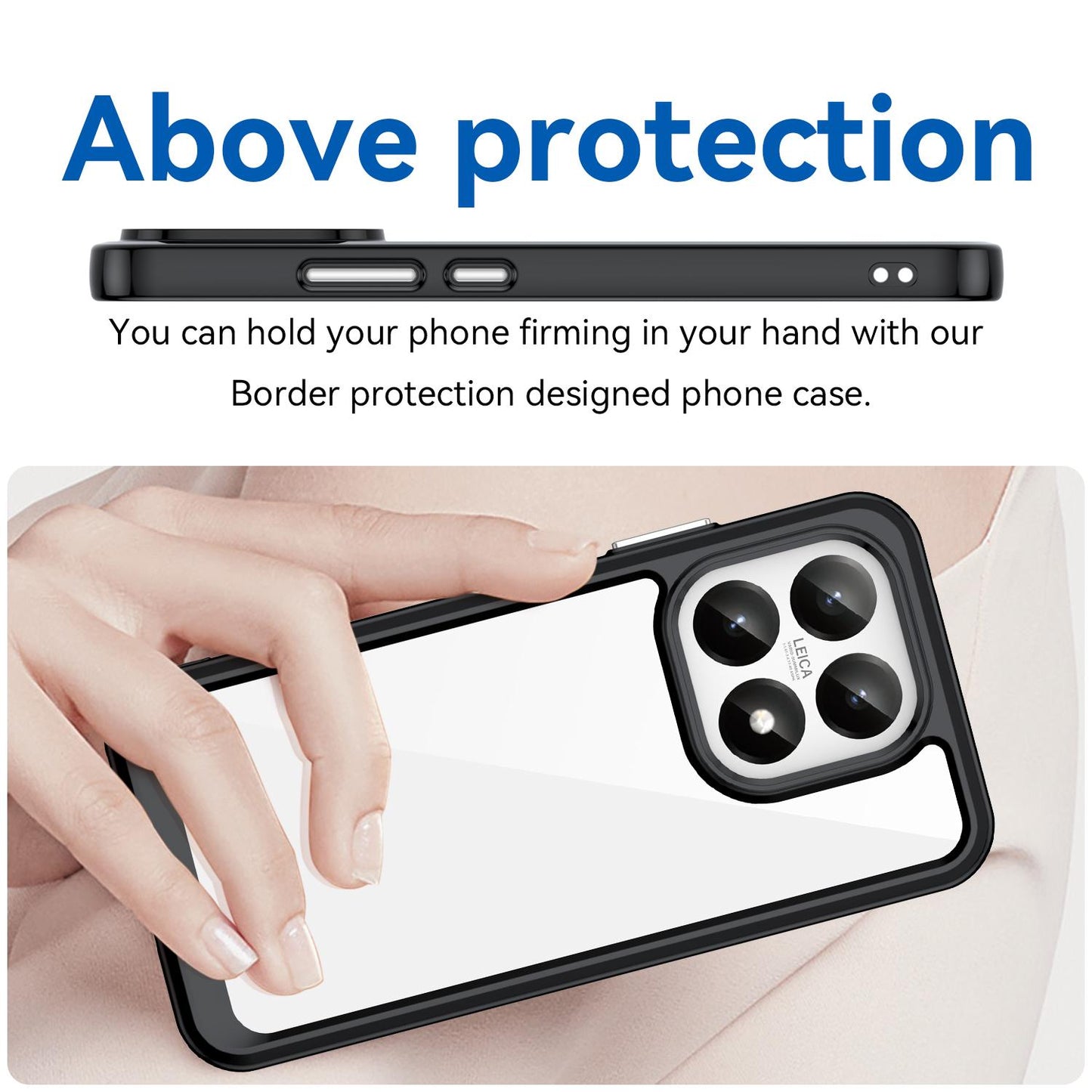 Xiaomi 15T 5G Acrylic Hybrid TPU Protective Phone Case, Colourful Series Shockproof Cover