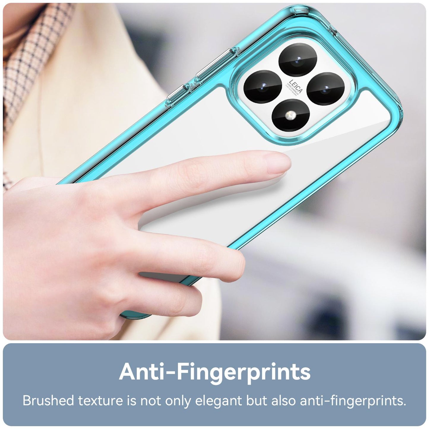 Xiaomi 15T 5G Acrylic Hybrid TPU Protective Phone Case, Colourful Series Shockproof Cover