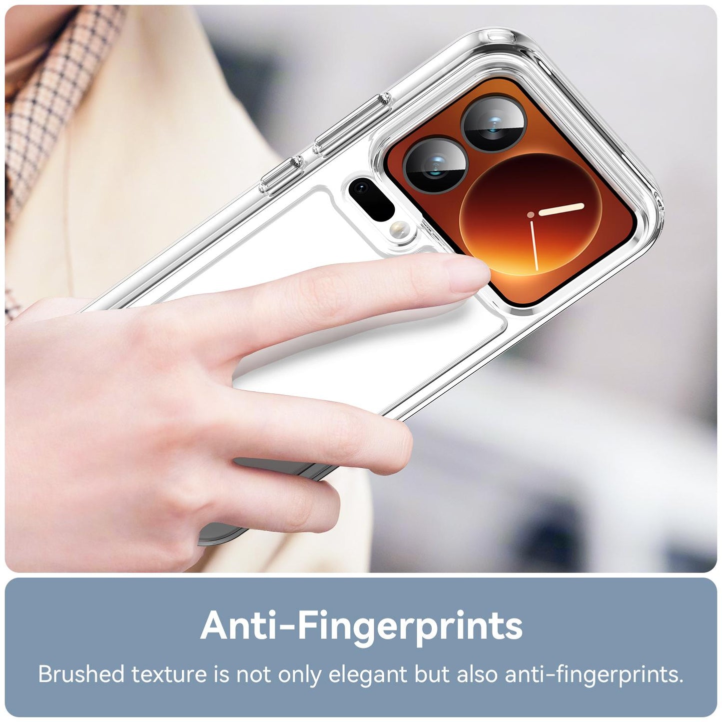 Xiaomi 17 Pro Acrylic Hybrid TPU Protective Phone Case, Colourful Series Shockproof Cover