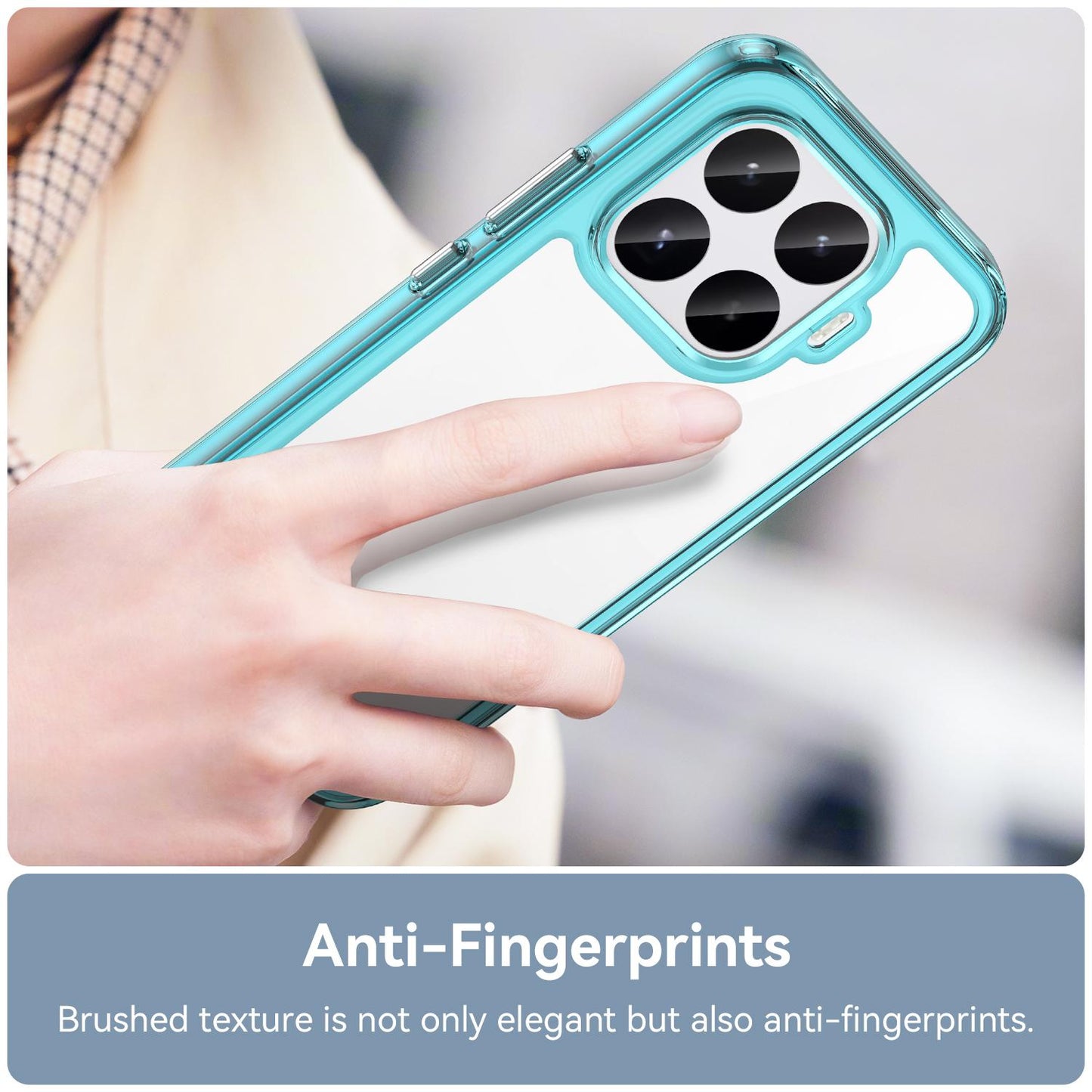 Xiaomi 17T 5G Acrylic Hybrid TPU Protective Phone Case, Colourful Series Shockproof Cover