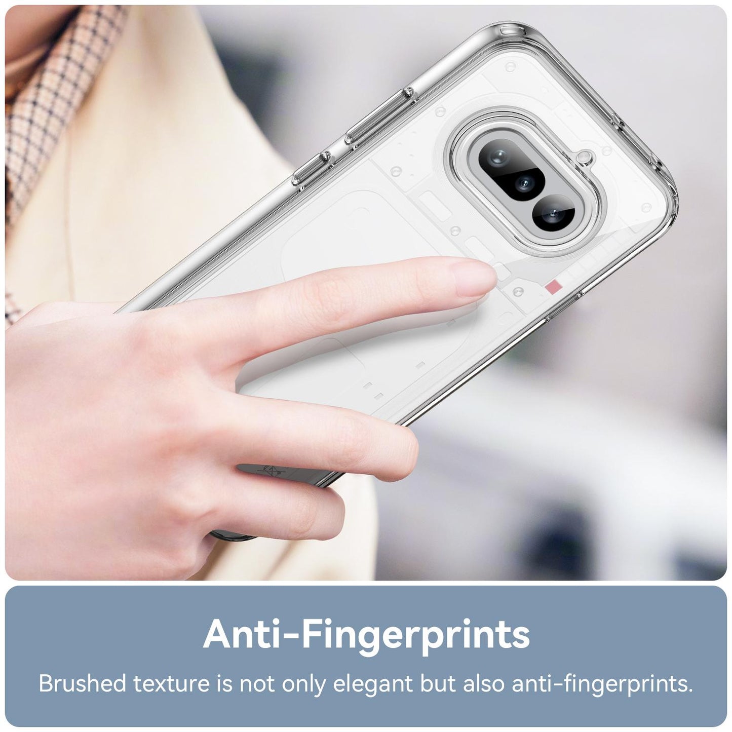Nothing Phone 4a Electroplated Buttons TPU Acrylic Phone Case with Screen Protector - Heavy Duty Shockproof Cover, Air Cushion Corners, Raised Camera & Screen Protection, HD Tempered Glass Full Coverage Protective Case
