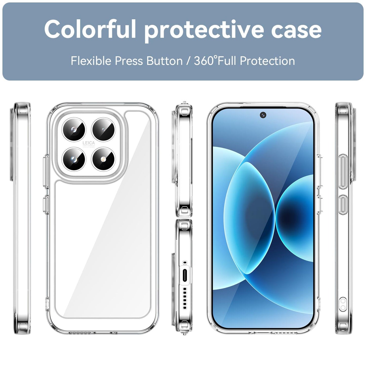 Xiaomi 17 Electroplated Buttons TPU Acrylic Phone Case with Screen Protector - Heavy Duty Shockproof Cover, Air Cushion Corners, Raised Camera & Screen Protection, HD Tempered Glass Full Coverage Protective Case