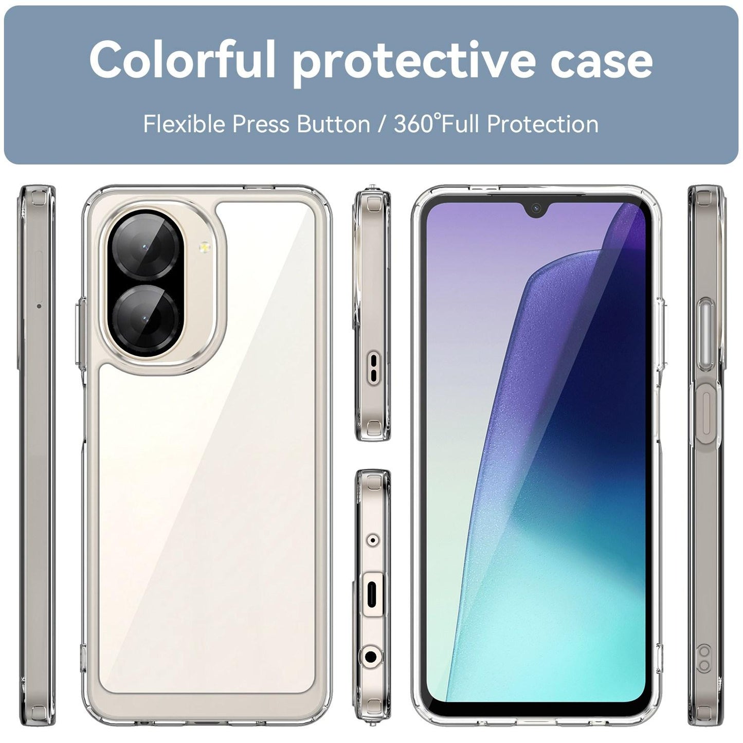 Xiaomi Redmi A5 NFC 173mm Electroplated Buttons TPU Acrylic Phone Case with Screen Protector - Heavy Duty Shockproof Cover, Air Cushion Corners, Raised Camera & Screen Protection, HD Tempered Glass Full Coverage Protective Case