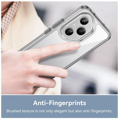 Honor 400 Pro 160.8mm Electroplated Buttons TPU Acrylic Phone Case with Screen Protector - Heavy Duty Shockproof Cover, Air Cushion Corners, Raised Camera & Screen Protection, HD Tempered Glass Full Coverage Protective Case